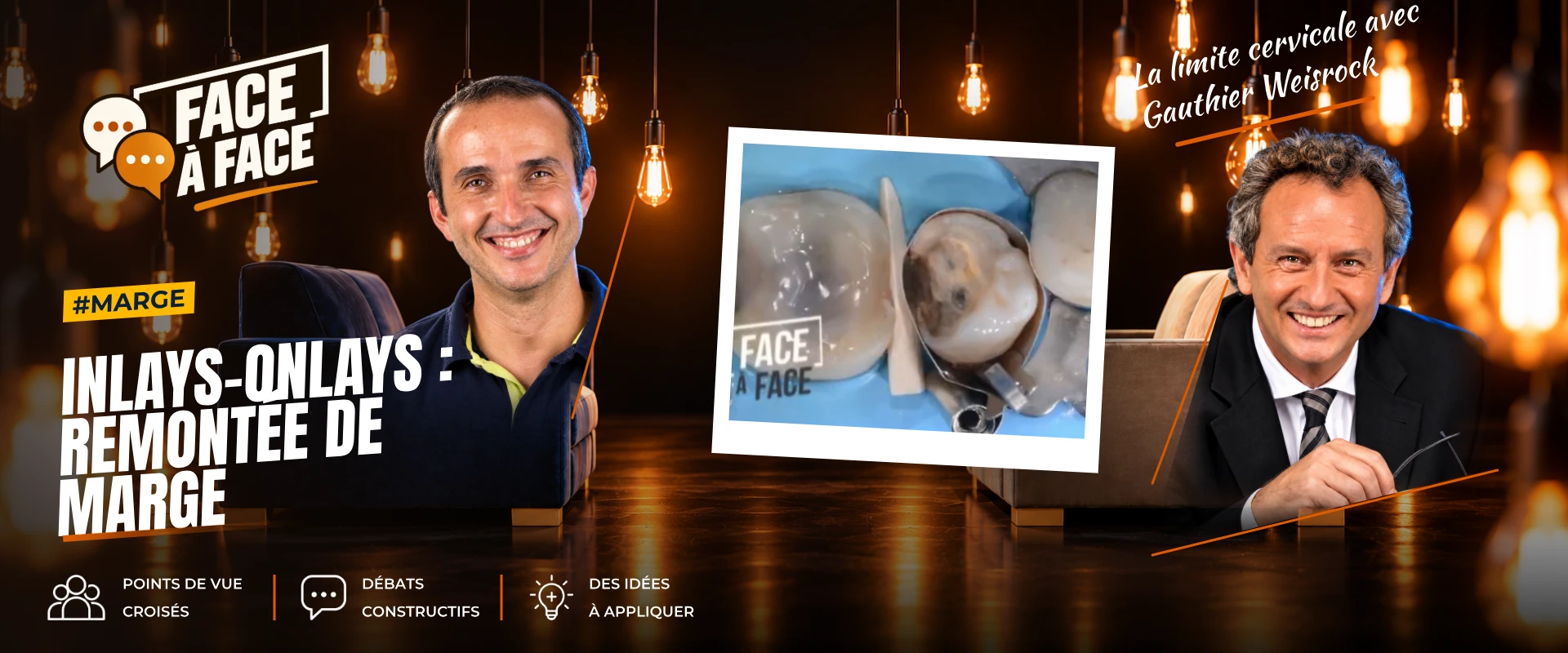 Inlays-onlays : remontée de marge (Face à Face, saison 1 épisode 52)