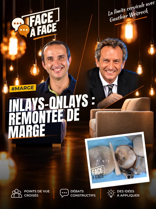 Inlays-onlays : remontée de marge (Face à Face, saison 1 épisode 52)