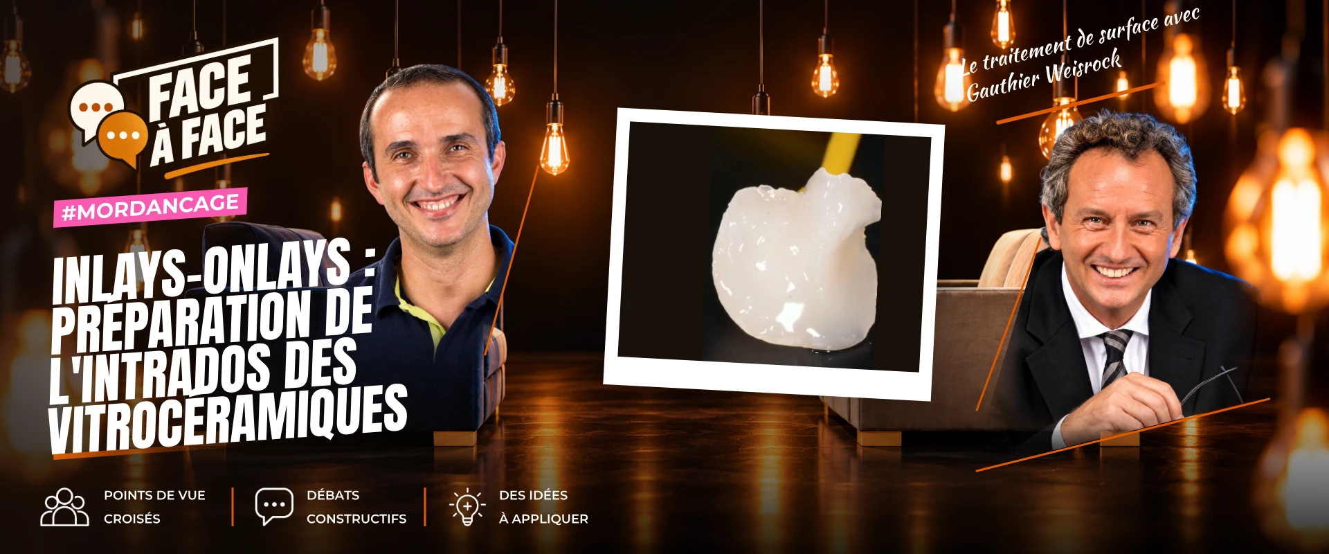 Inlays-onlays : préparation de l'intrados des vitrocéramiques (Face à Face, saison 1 épisode 54)