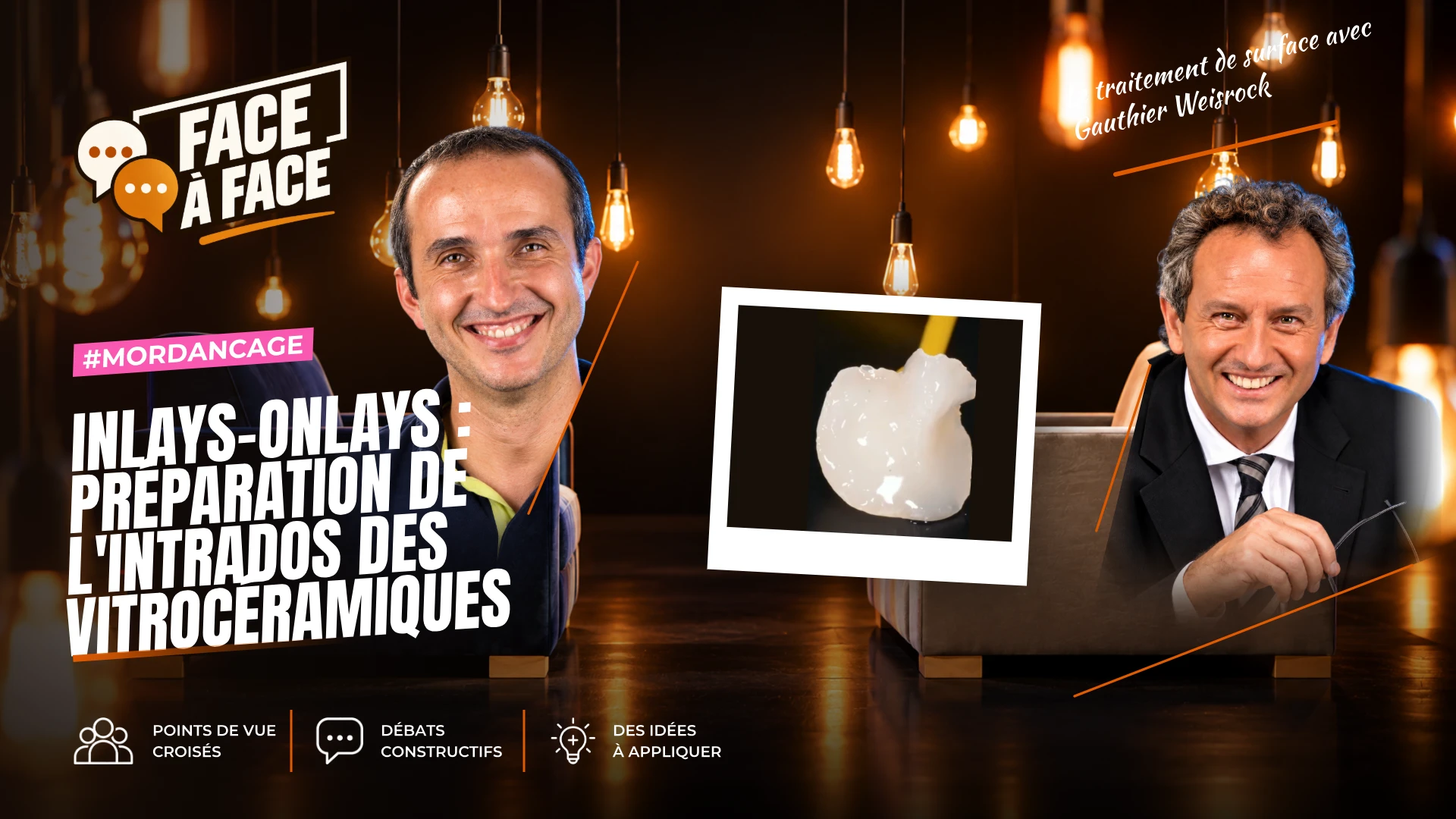 Inlays-onlays : préparation de l'intrados des vitrocéramiques (Face à Face, saison 1 épisode 54)