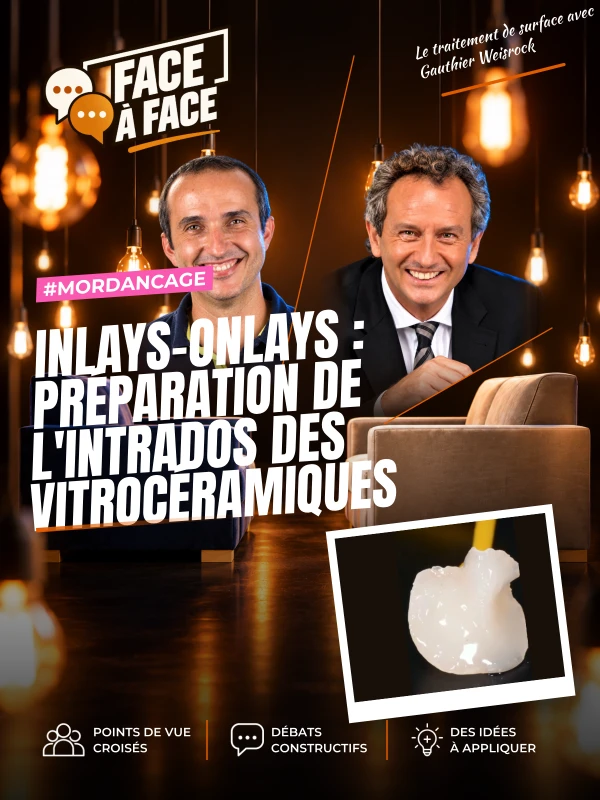 Inlays-onlays : préparation de l'intrados des vitrocéramiques (Face à Face, saison 1 épisode 54)