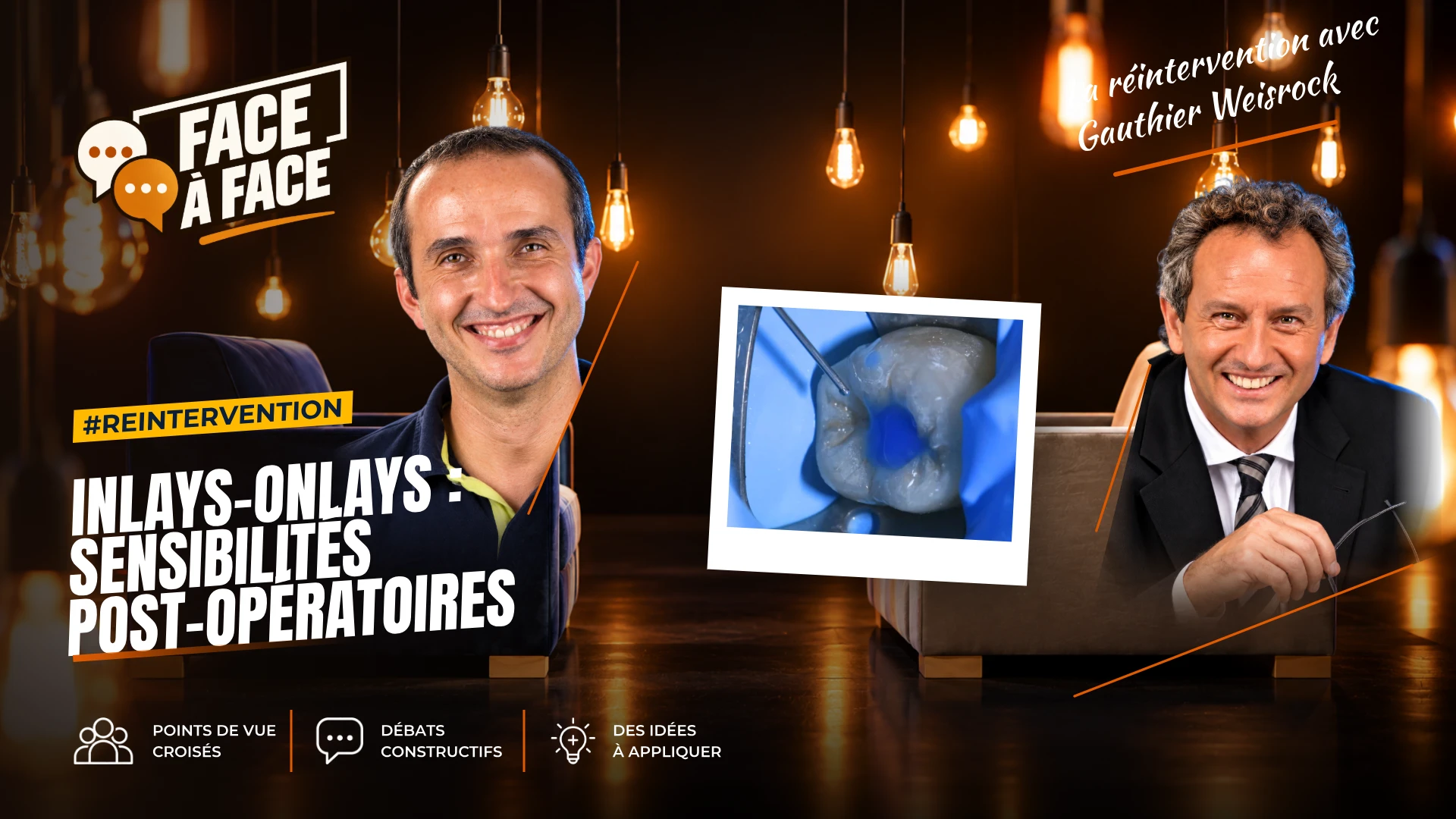 Inlays-onlays : sensibilités post-opératoires (Face à Face, saison 1 épisode 55)