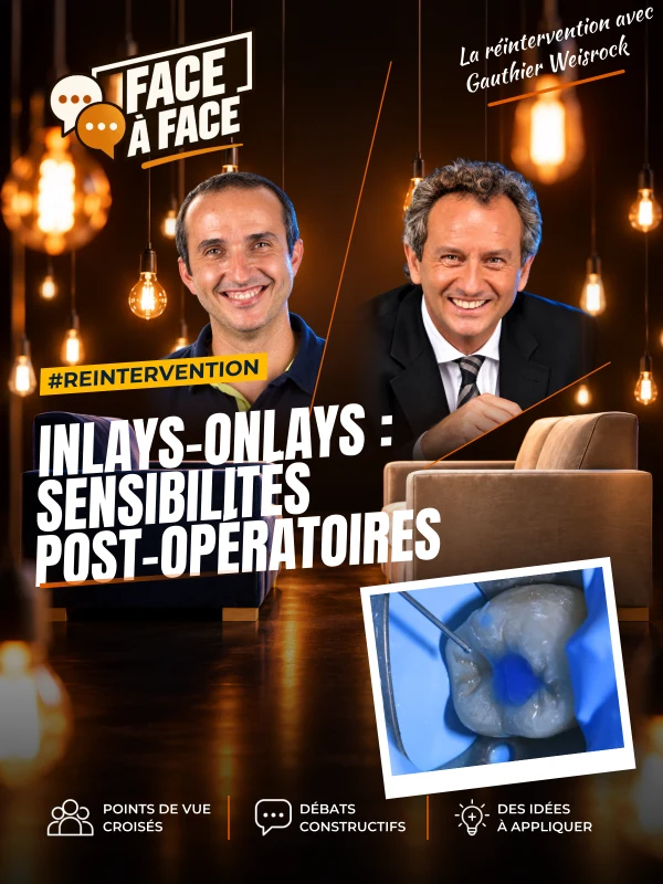 Inlays-onlays : sensibilités post-opératoires (Face à Face, saison 1 épisode 55)