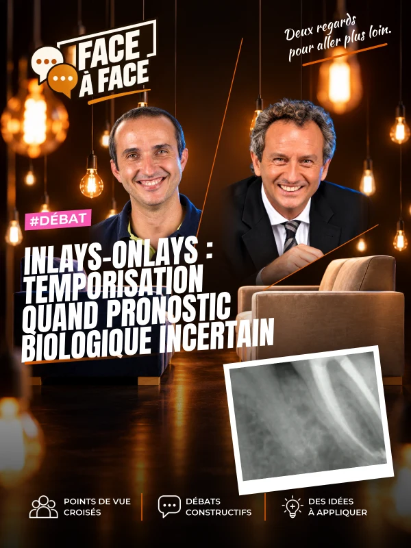 Inlays-onlays : temporisation quand pronostic biologique incertain (Face à Face, saison 1 épisode 56)