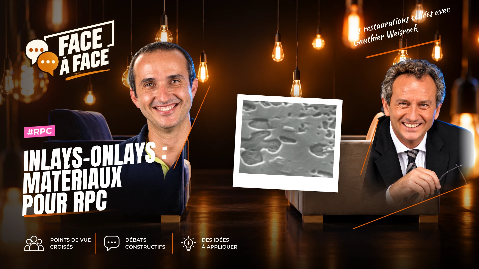 Inlays-onlays : matériaux pour rpc (Face à Face, saison 1 épisode 57) : Inlays-Onlays : matériaux pour RPC : composites, matériaux hybrides et…