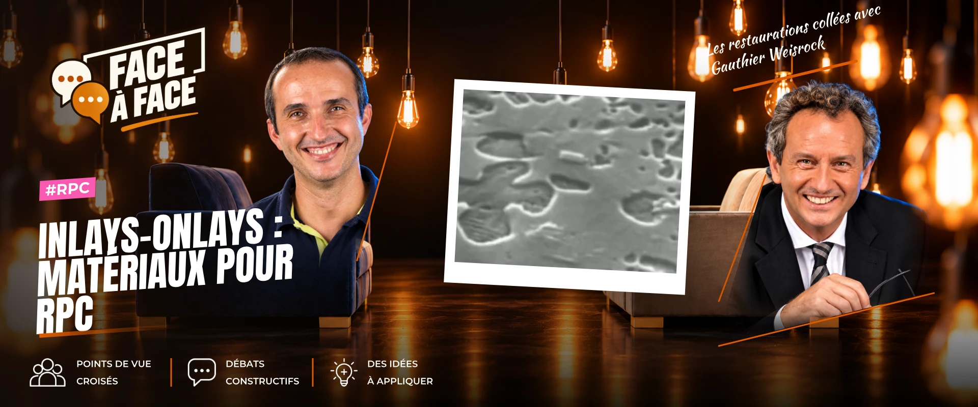 Inlays-onlays : matériaux pour rpc (Face à Face, saison 1 épisode 57) : Inlays-Onlays : matériaux pour RPC : composites, matériaux hybrides et…
