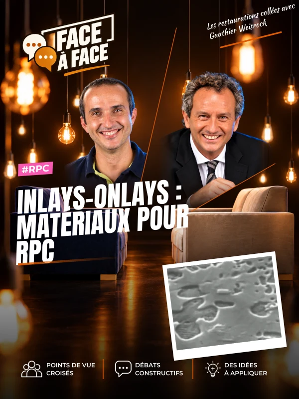 Inlays-onlays : matériaux pour rpc (Face à Face, saison 1 épisode 57) : Inlays-Onlays : matériaux pour RPC : composites, matériaux hybrides et…