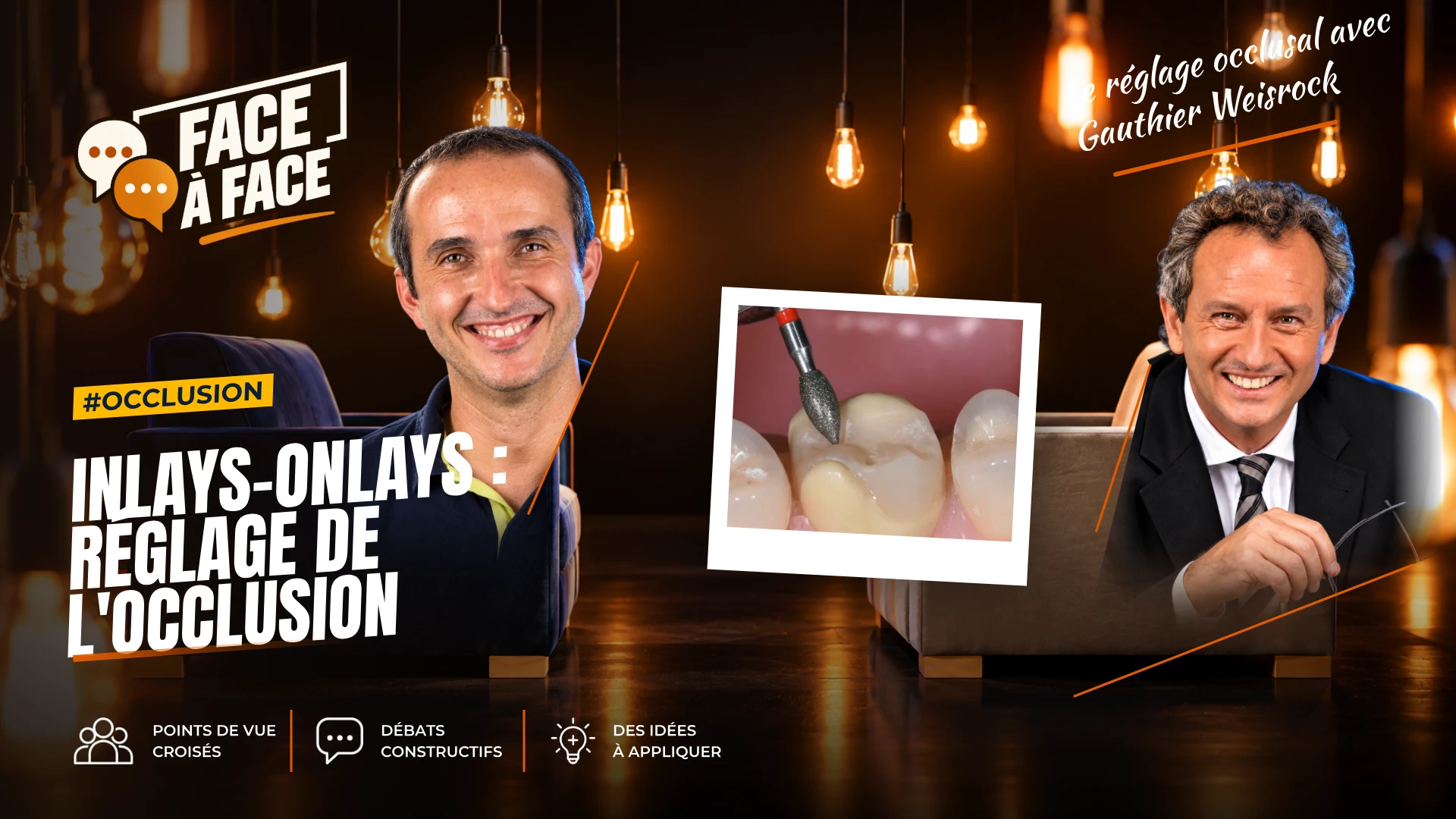 Inlays-onlays : réglage de l'occlusion (Face à Face, saison 1 épisode 58)