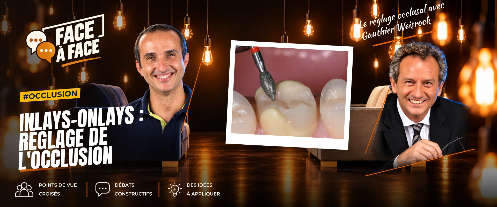 Inlays-onlays : réglage de l'occlusion (Face à Face, saison 1 épisode 58)