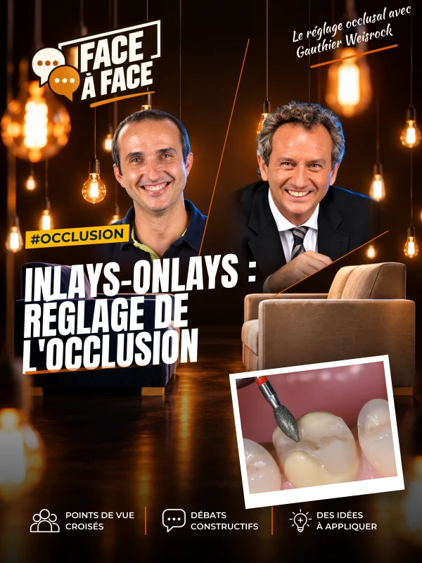 Inlays-onlays : réglage de l'occlusion (Face à Face, saison 1 épisode 58)