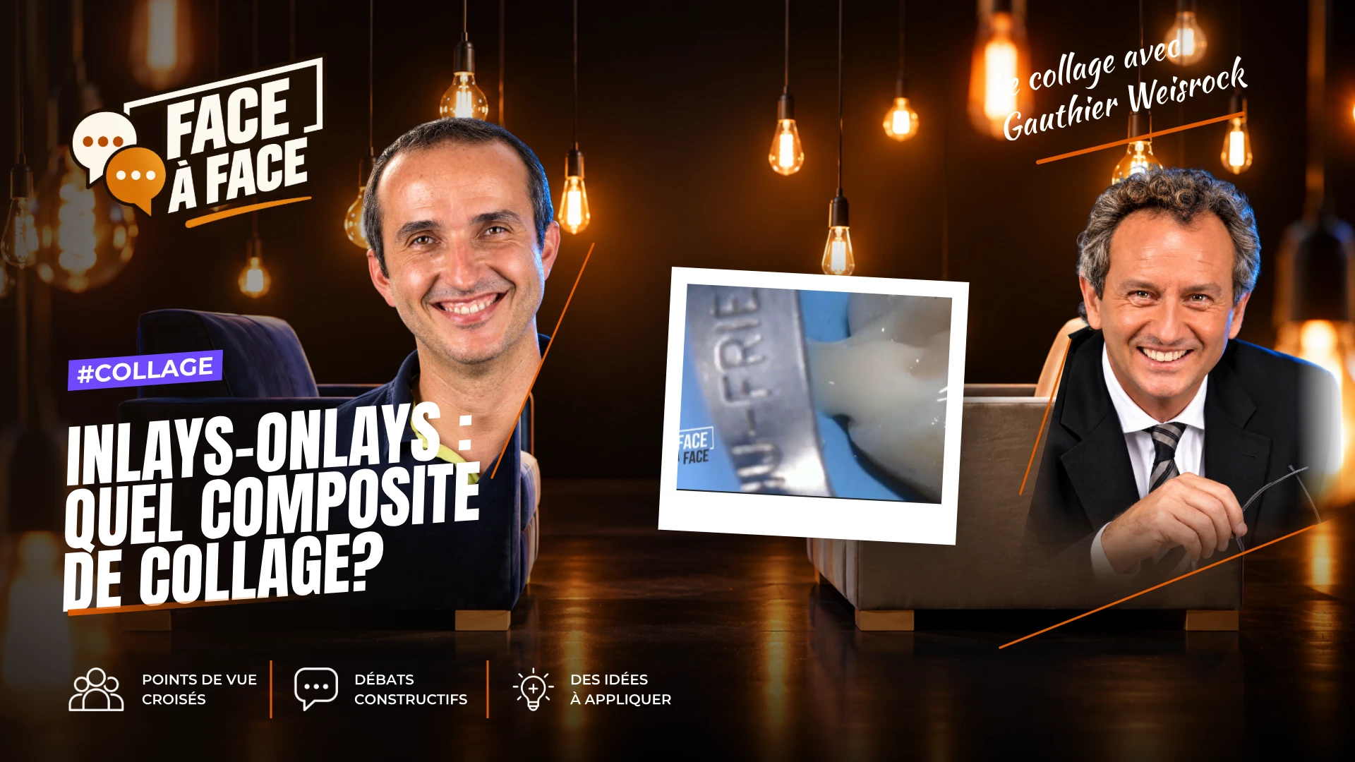 Inlays-onlays : quel composite de collage? (Face à Face, saison 1 épisode 59) : Inlays-Onlays : Quels composite de collage?