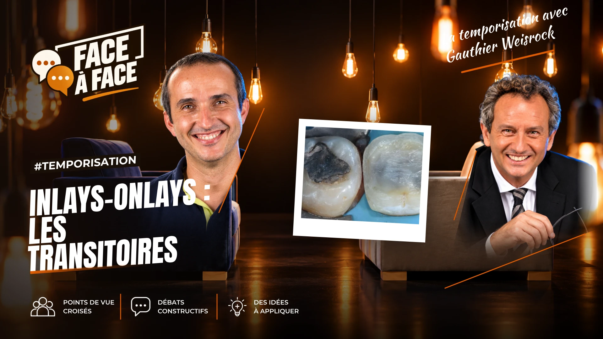 Inlays-onlays : les transitoires (Face à Face, saison 1 épisode 60) : Inlays-Onlays : les transitoires .