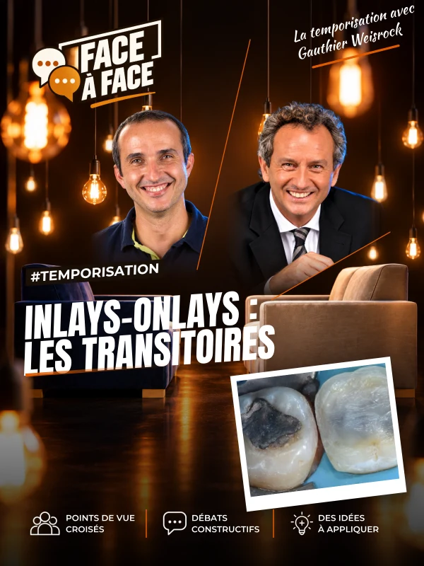 Inlays-onlays : les transitoires (Face à Face, saison 1 épisode 60) : Inlays-Onlays : les transitoires .