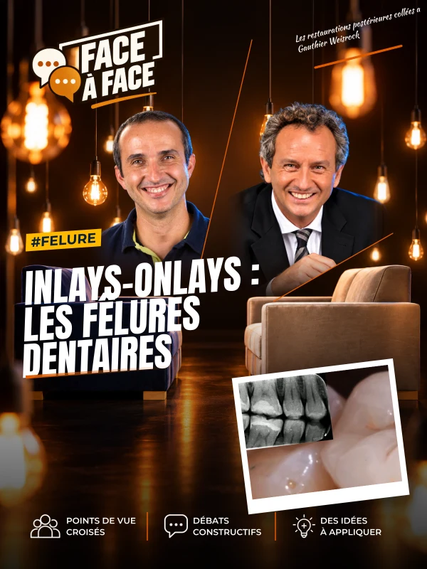 Inlays-onlays : les fêlures dentaires (Face à Face, saison 1 épisode 61)