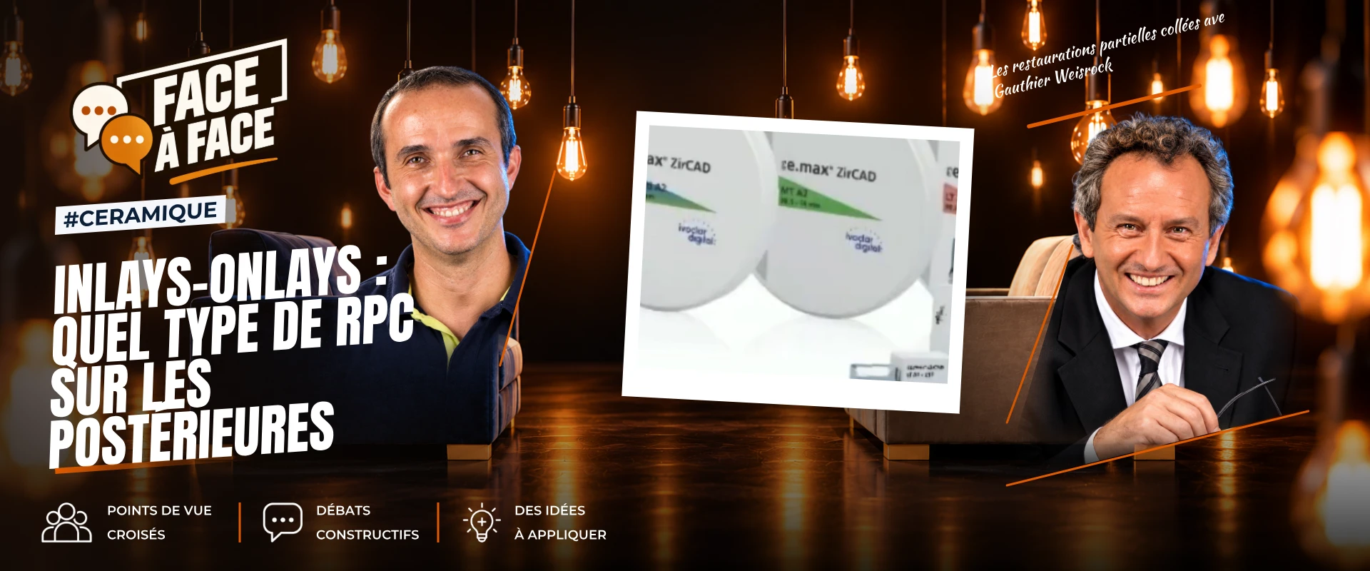 Inlays-onlays : quel type de rpc sur les postérieures (Face à Face, saison 1 épisode 62)