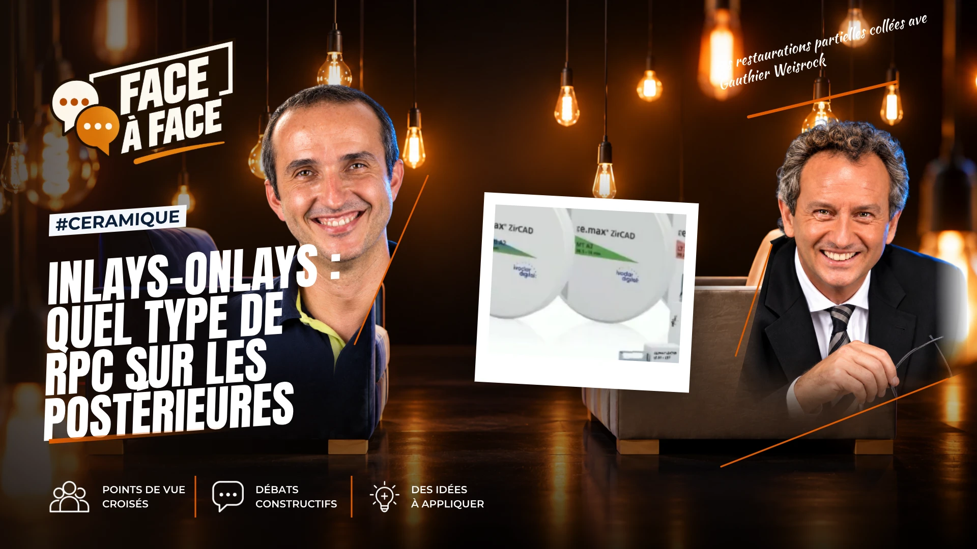Inlays-onlays : quel type de rpc sur les postérieures (Face à Face, saison 1 épisode 62)