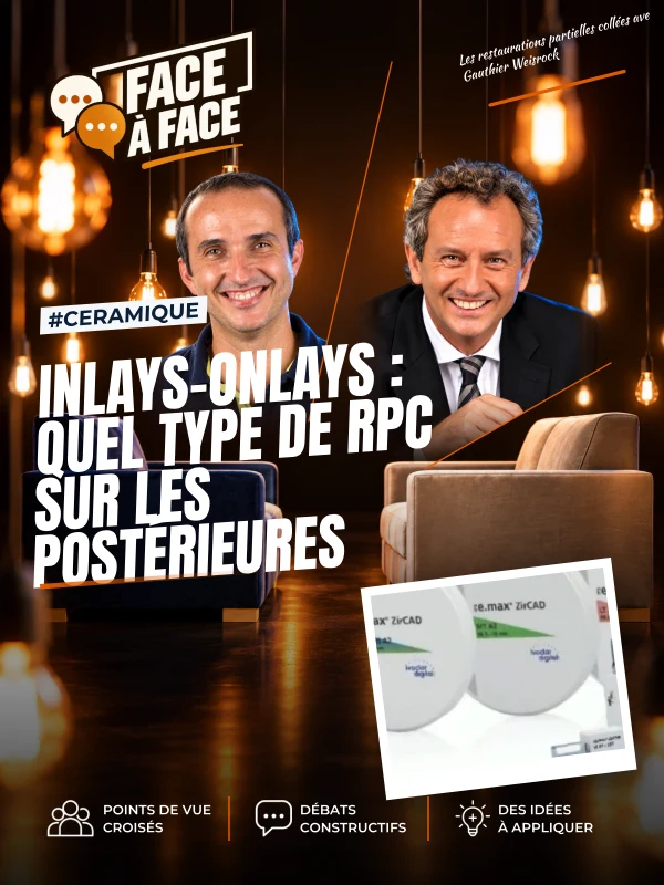 Inlays-onlays : quel type de rpc sur les postérieures (Face à Face, saison 1 épisode 62)