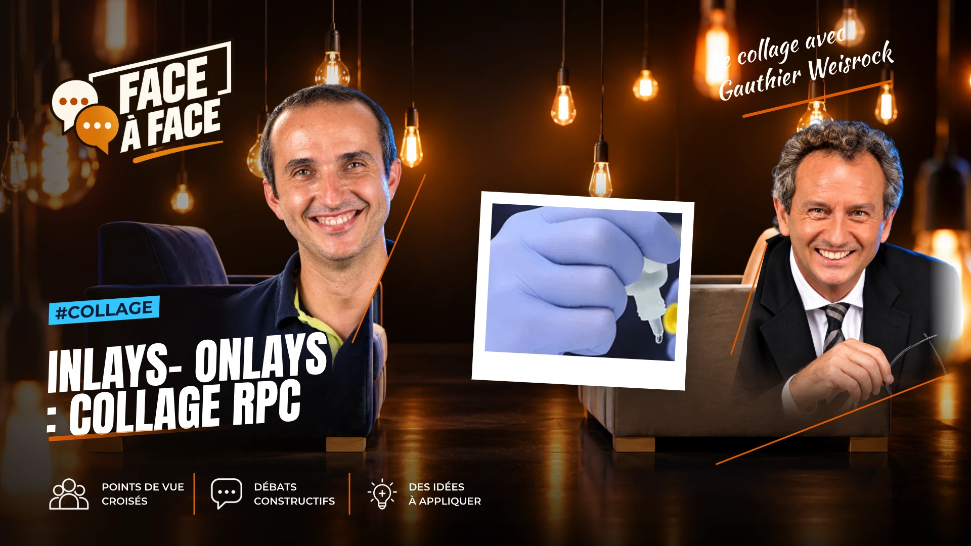 Inlays- onlays : collage rpc (Face à Face, saison 1 épisode 63) : Inlays- Onlays : collage RPC : types de colles, abandon des ciments , conseils…