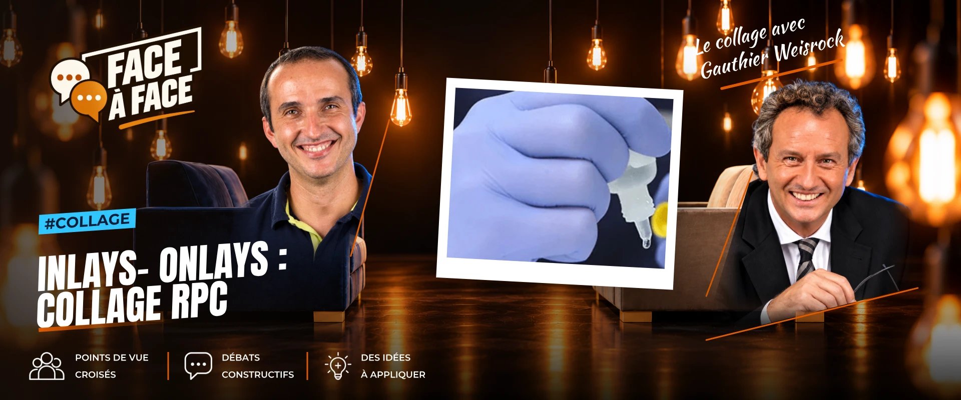 Inlays- onlays : collage rpc (Face à Face, saison 1 épisode 63) : Inlays- Onlays : collage RPC : types de colles, abandon des ciments , conseils…