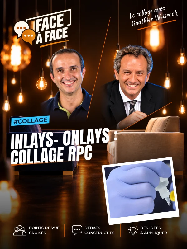 Inlays- onlays : collage rpc (Face à Face, saison 1 épisode 63) : Inlays- Onlays : collage RPC : types de colles, abandon des ciments , conseils…