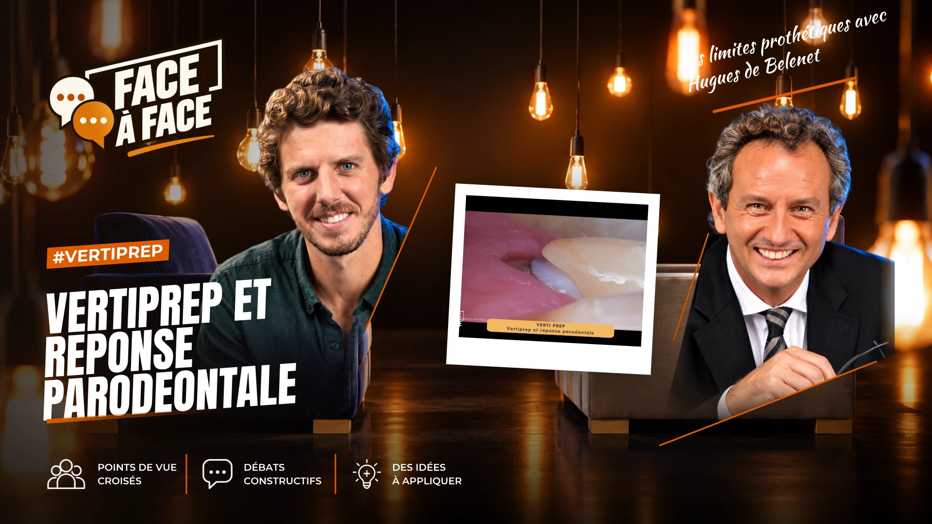 Vertiprep et reponse parodeontale (Face à Face, saison 2 épisode 4) : Que dit la littérature sur la réponse parodontale aux limites prothétiques ?