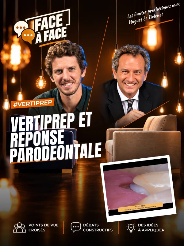 Vertiprep et reponse parodeontale (Face à Face, saison 2 épisode 4) : Que dit la littérature sur la réponse parodontale aux limites prothétiques ?
