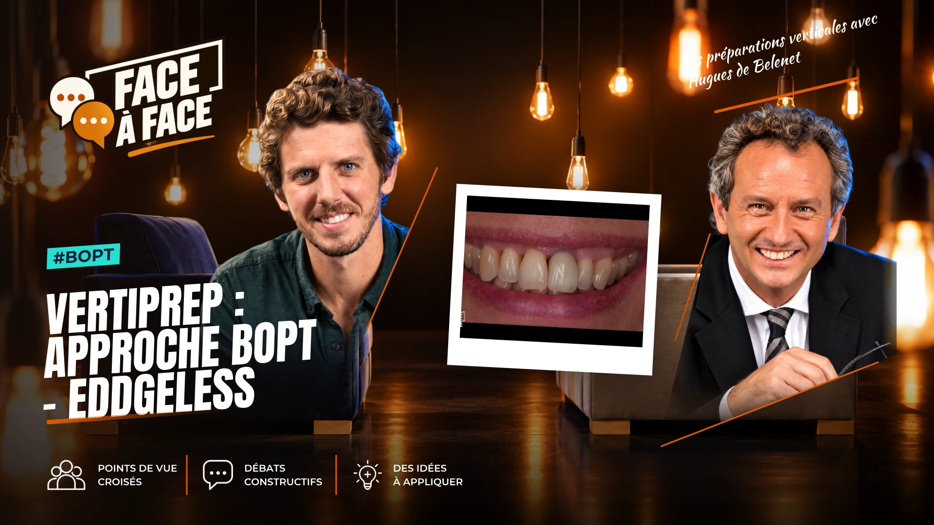 Vertiprep : approche bopt - eddgeless (Face à Face, saison 2 épisode 5) : La technique BOPT décryptée : préparation profonde, blessure gingivale…