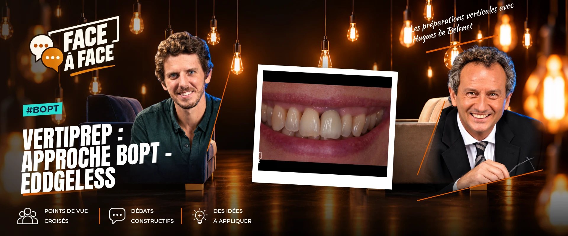 Vertiprep : approche bopt - eddgeless (Face à Face, saison 2 épisode 5) : La technique BOPT décryptée : préparation profonde, blessure gingivale…