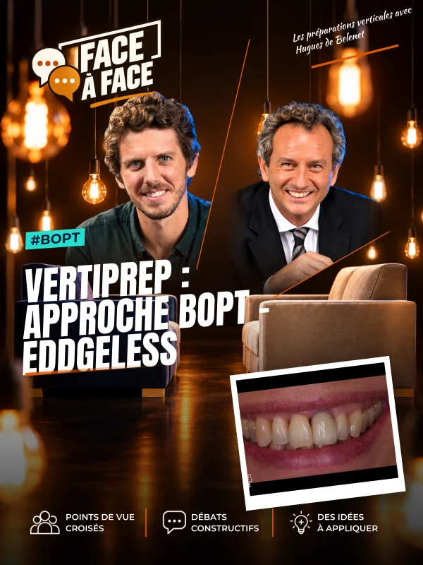 Vertiprep : approche bopt - eddgeless (Face à Face, saison 2 épisode 5) : La technique BOPT décryptée : préparation profonde, blessure gingivale…