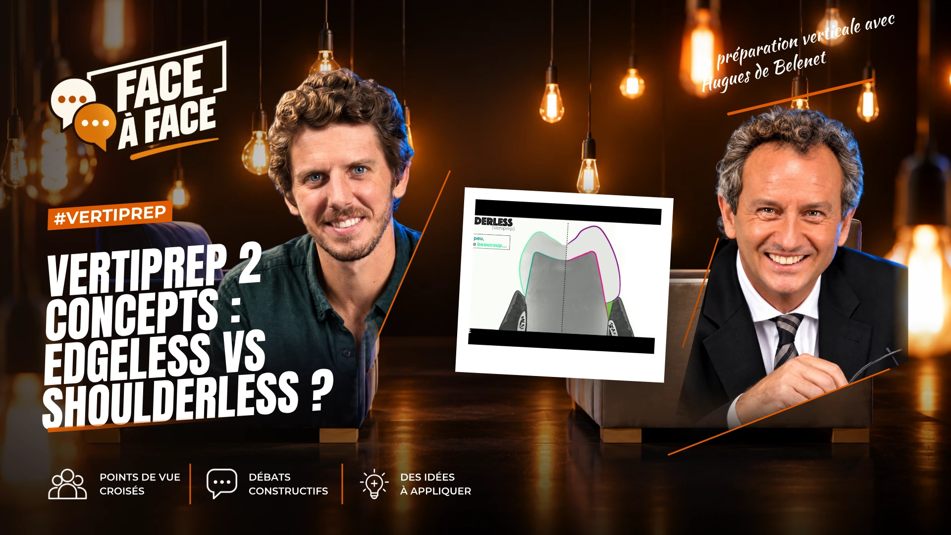 Vertiprep 2 concepts edgeless vs shoulderless (Face à Face, saison 2 épisode 7) : Edgeless ou shoulderless ?