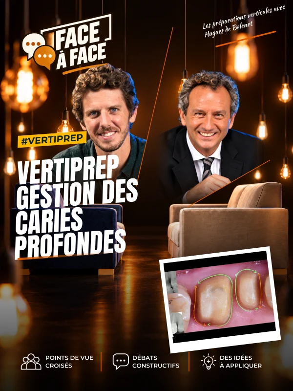 Vertiprep gestion des caries profondes (Face à Face, saison 2 épisode 8) : Caries sous-gingivales : élongation coronaire ou remontée de marge ?