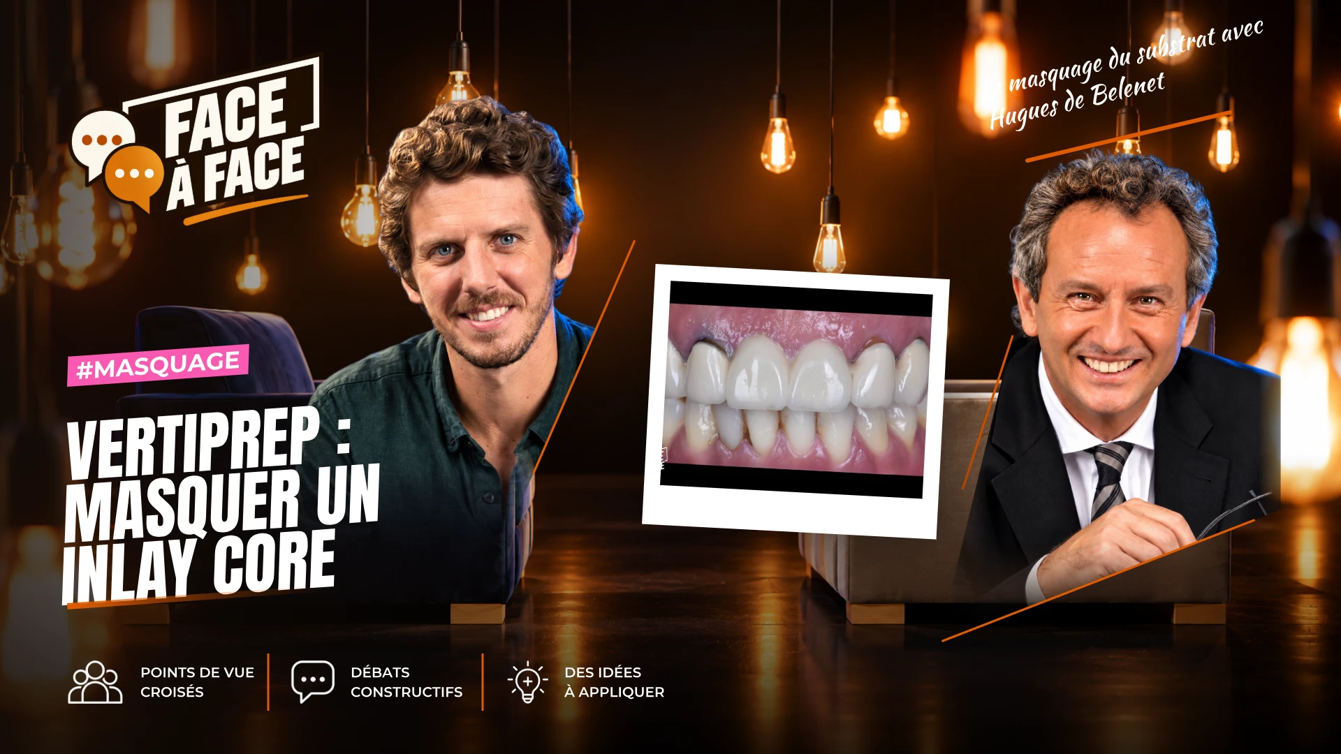 Vertiprep : masquer un inlay core (Face à Face, saison 2 épisode 11) : Comment masquer un substrat dyschromique en VertiPrep sans démonter un…