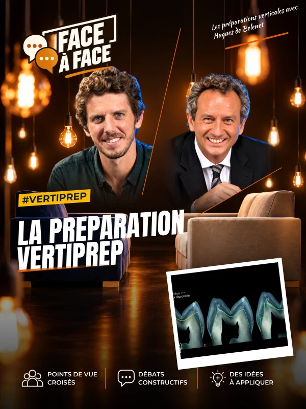 La preparation vertiprep (Face à Face, saison 2 épisode 12) : La préparation VertiPrep pas à pas : la fraise « de batte » comme guide, la mise de…