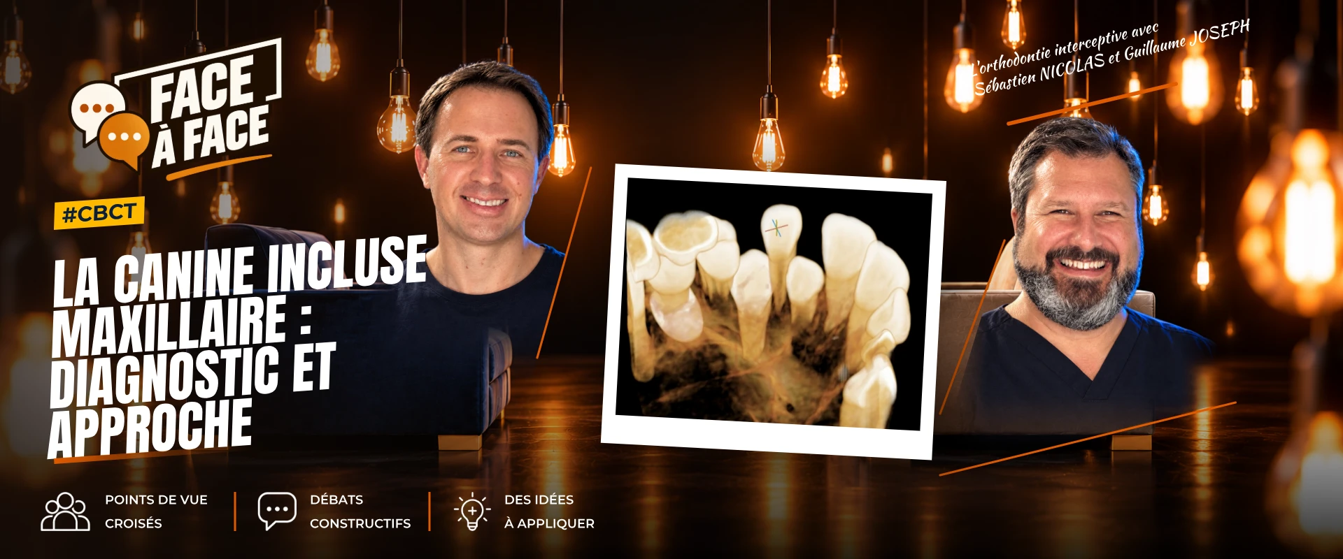 La canine incluse maxillaire : diagnostic et approche