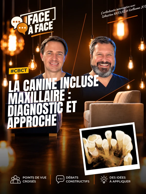 La canine incluse maxillaire : diagnostic et approche 