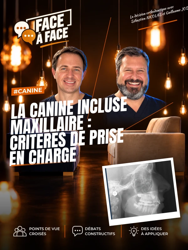 La canine incluse maxillaire : criteres de prise en charge