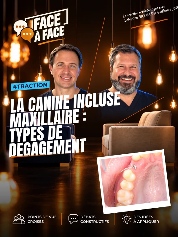 La canine incluse maxillaire : types de degagement 
