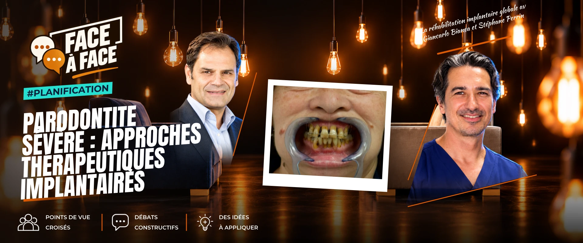 Parodontite sévère : analyse du sourire (Face à Face, saison 2 épisode 20) : Parodontite sévère : l'analyse du sourire au service d'une…