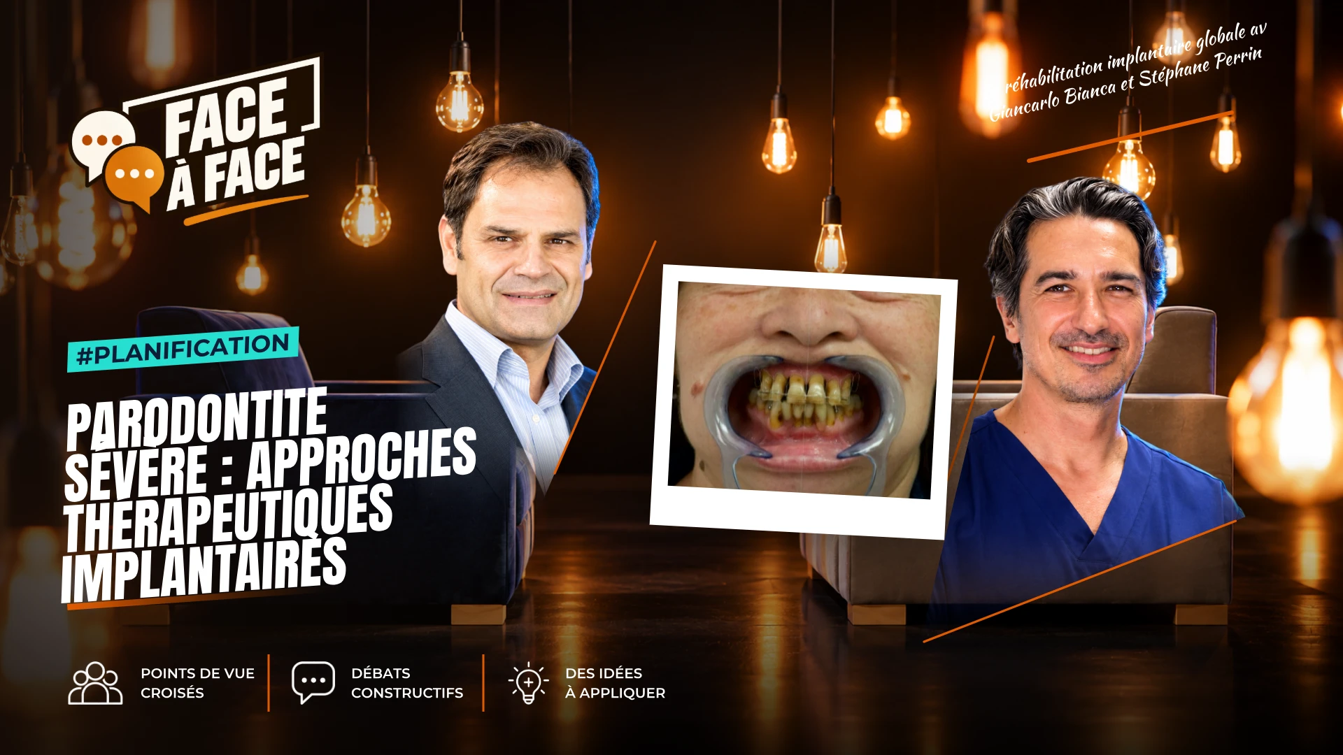 Parodontite sévère : analyse du sourire (Face à Face, saison 2 épisode 20) : Parodontite sévère : l'analyse du sourire au service d'une…