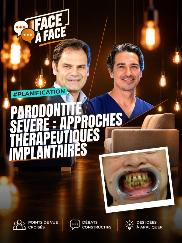 Parodontite sévère : analyse du sourire (Face à Face, saison 2 épisode 20) : Parodontite sévère : l'analyse du sourire au service d'une…