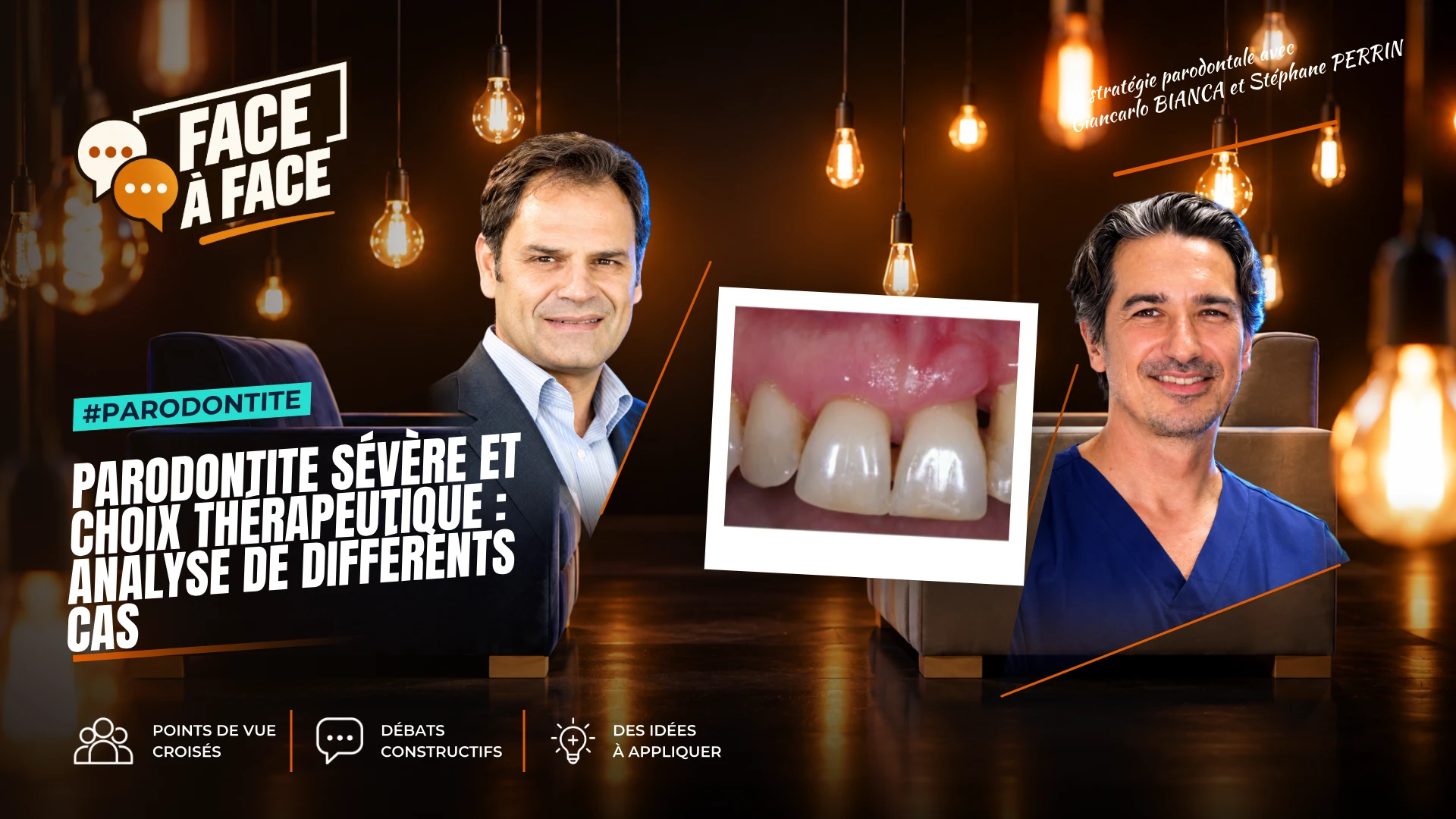Parodontite sévère et choix thérapeutique : analyse de différents cas (Face à Face, saison 2 épisode 21) : Parodontite sévère : comment choisir la…