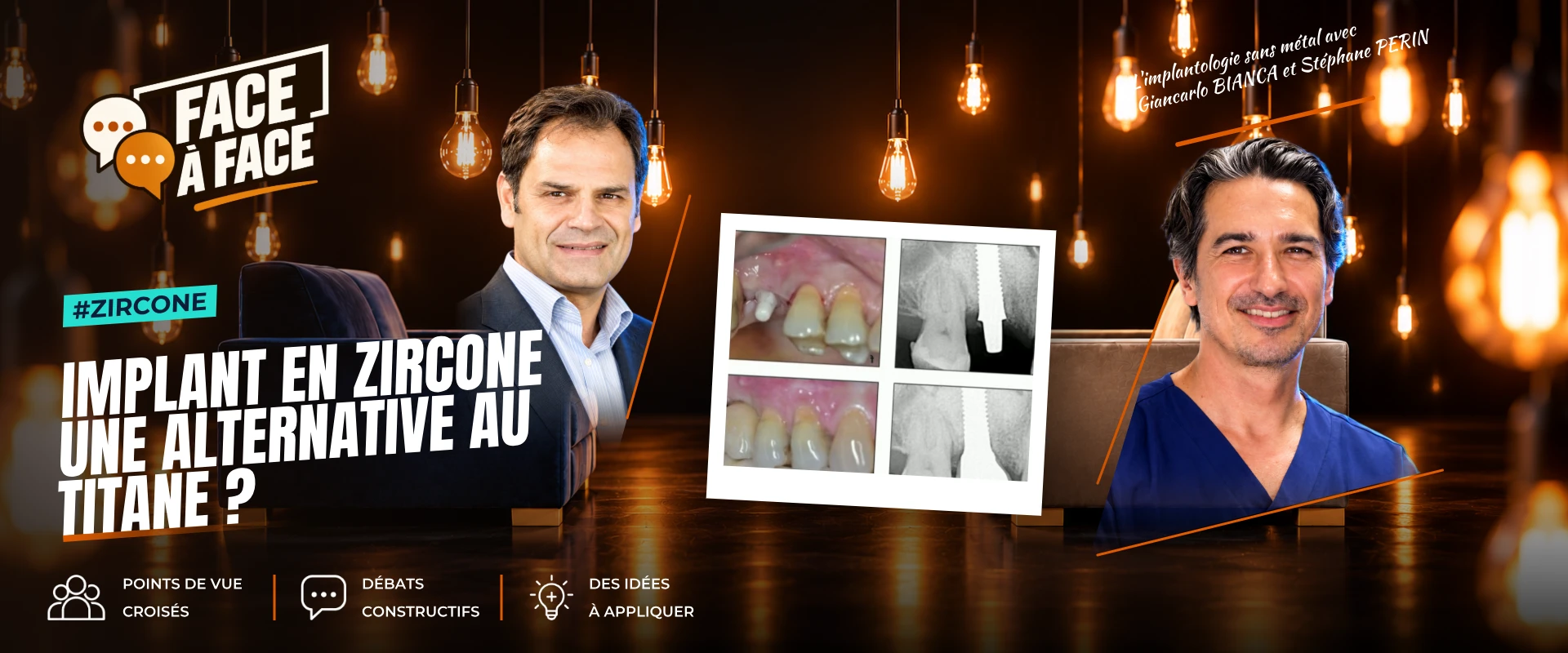 Implant en zircone une alternative au titane ? (Face à Face, saison 2 épisode 22) : L'implant en zircone, alternative au titane ?