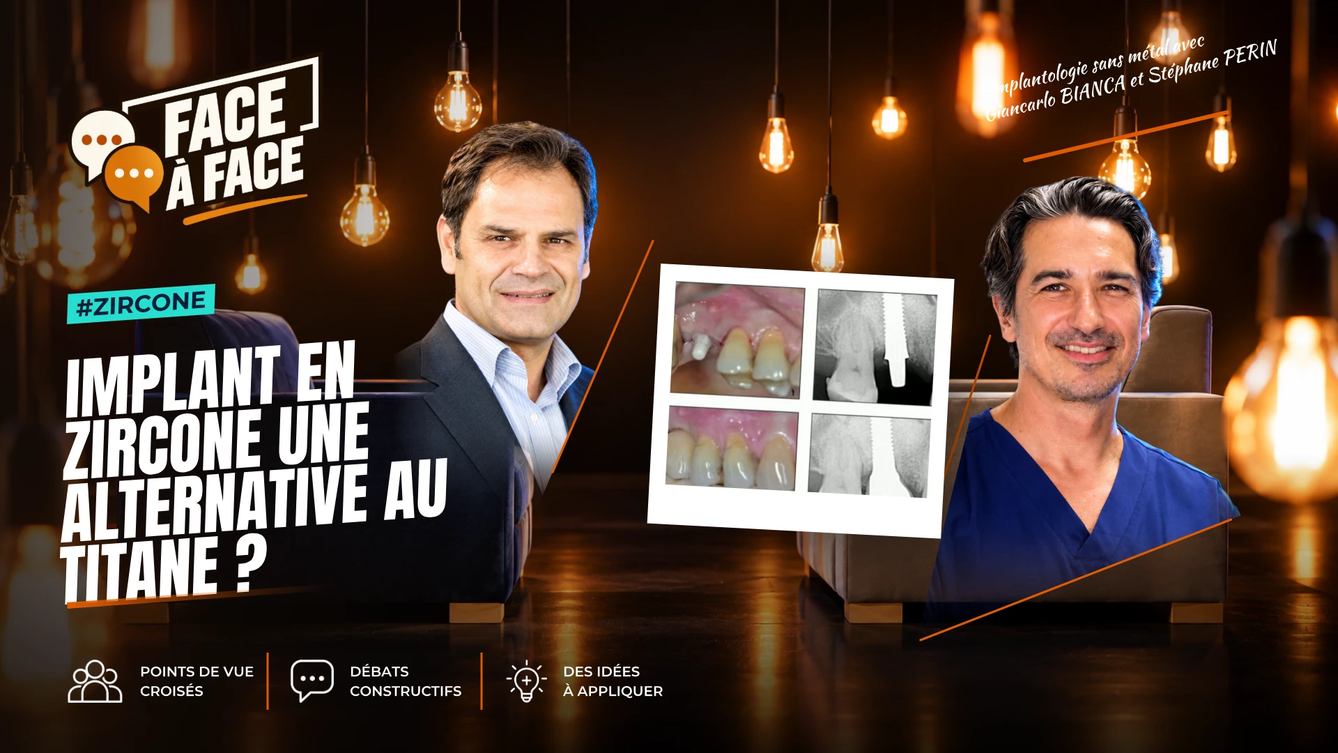 Implant en zircone une alternative au titane ? (Face à Face, saison 2 épisode 22) : L'implant en zircone, alternative au titane ?