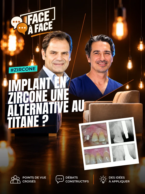 Implant en zircone une alternative au titane ? (Face à Face, saison 2 épisode 22) : L'implant en zircone, alternative au titane ?