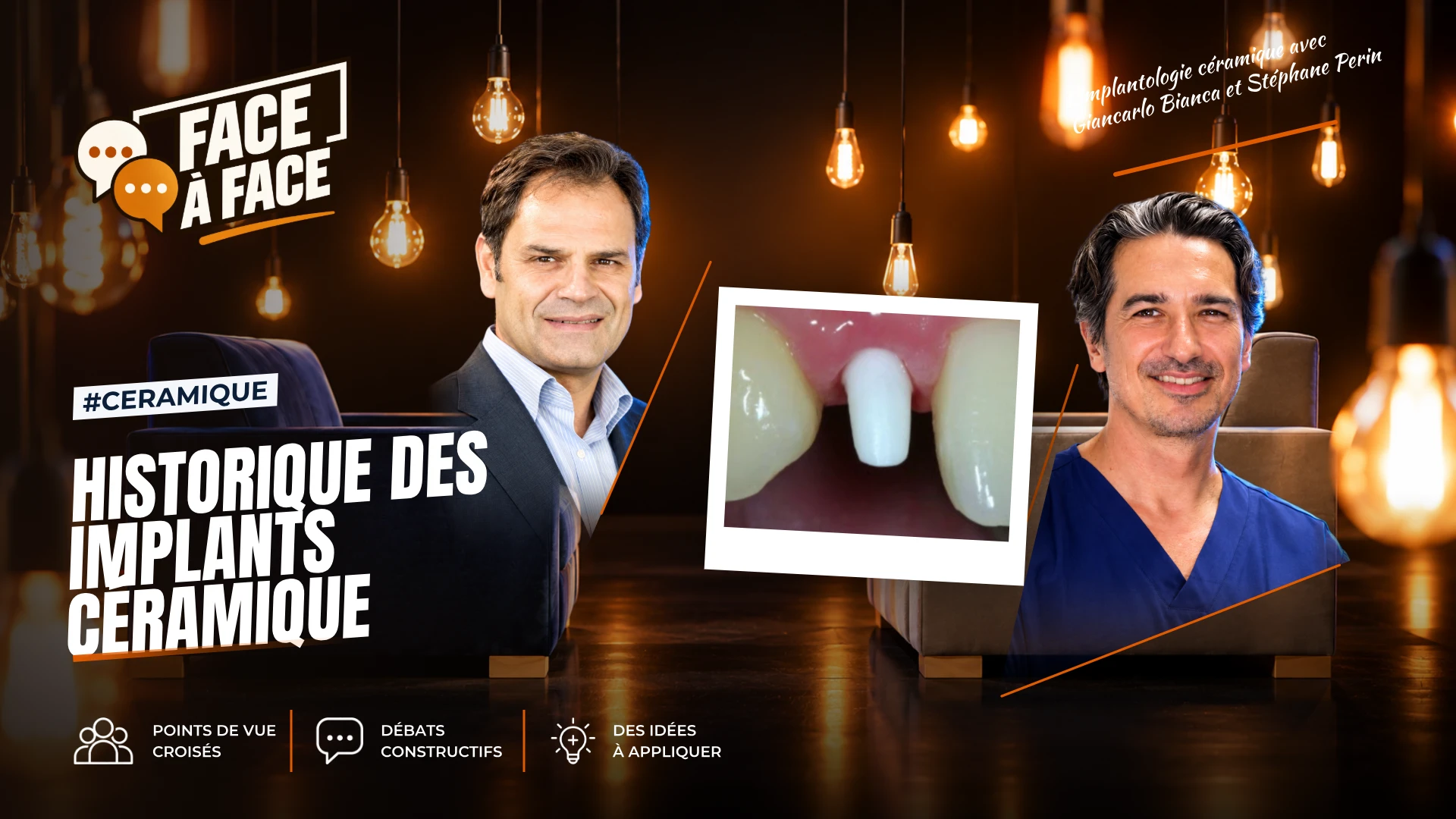 Historique des implants céramique (Face à Face, saison 2 épisode 24) : L'histoire des implants céramiques, des pionniers des années 60 à la zircone…
