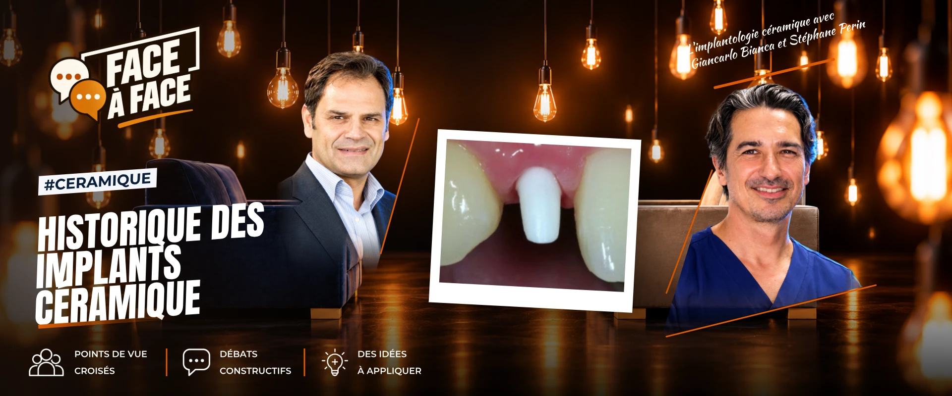 Historique des implants céramique (Face à Face, saison 2 épisode 24) : L'histoire des implants céramiques, des pionniers des années 60 à la zircone…