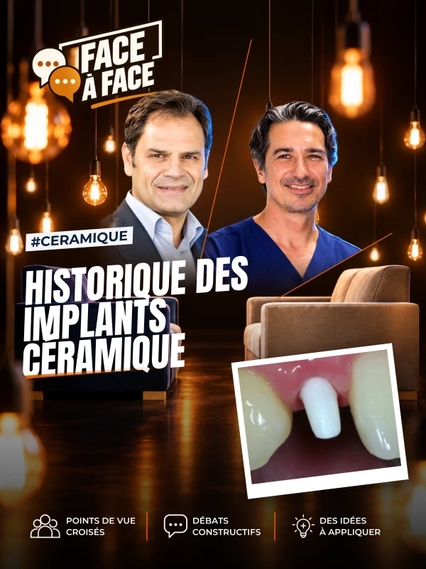 Historique des implants céramique (Face à Face, saison 2 épisode 24) : L'histoire des implants céramiques, des pionniers des années 60 à la zircone…