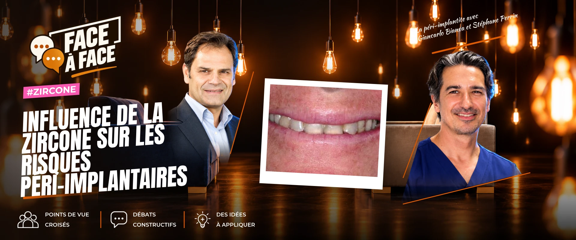 Influence de la zircone sur les risques péri-implantaires (Face à Face, saison 2 épisode 25) : La zircone réduit-elle les risques péri-implantaires ?