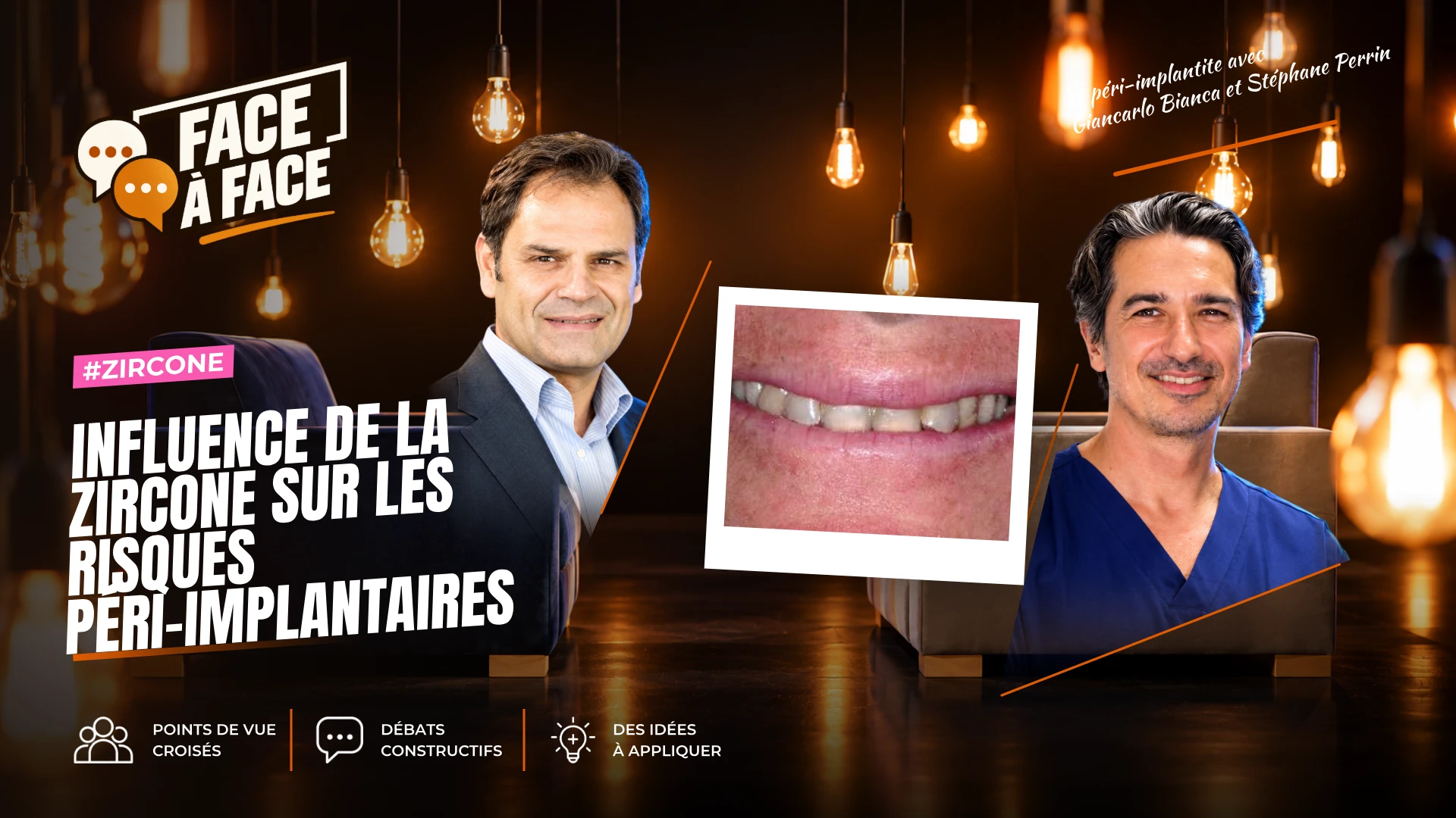 Influence de la zircone sur les risques péri-implantaires (Face à Face, saison 2 épisode 25) : La zircone réduit-elle les risques péri-implantaires ?