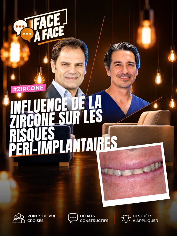 Influence de la zircone sur les risques péri-implantaires (Face à Face, saison 2 épisode 25) : La zircone réduit-elle les risques péri-implantaires ?